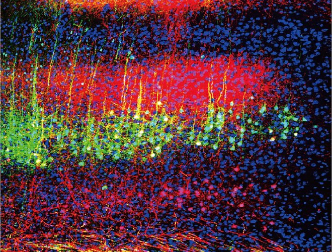 Звук понизил активность нейронов в слуховой коре головного мозга